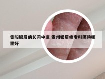 贵阳银屑病长问中康 贵州银屑病专科医院哪里好
