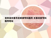 吉林省长春市皮肤病专科医院 长春皮肤专科医院地址