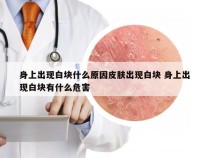 身上出现白块什么原因皮肤出现白块 身上出现白块有什么危害