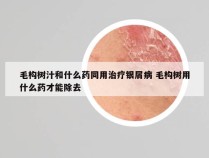 毛构树汁和什么药同用治疗银屑病 毛构树用什么药才能除去