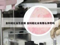 金科磁化水牛皮癣 金科磁化水有那么神奇吗