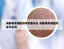 成都银屑病医院哪家最有名 成都银屑病医院挂号咨询