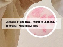 小孩子头上像是有癣一样有味道 小孩子头上像是有癣一样有味道正常吗