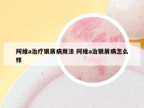 阿维a治疗银屑病用法 阿维a治银屑病怎么样