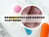 银屑病抹他克莫司为什么会痒 他克莫司软膏可以用于银屑病吗