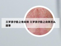 三岁孩子脸上有白斑 三岁孩子脸上白斑怎么回事