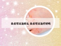 白点可以治好么 白点可以治疗好吗