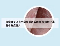 宝宝肚子上有小白点是怎么回事 宝宝肚子上有小白点图片