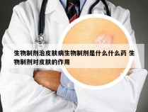 生物制剂治皮肤病生物制剂是什么什么药 生物制剂对皮肤的作用