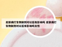 皮肤病打生物制剂对以后有影响吗 皮肤病打生物制剂对以后有影响吗女性
