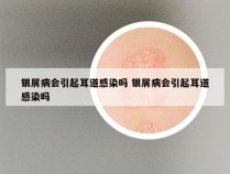 银屑病会引起耳道感染吗 银屑病会引起耳道感染吗