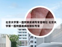 北京大学第一医院银屑病专家是哪位 北京大学第一医院银屑病皮肤科专家