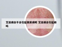 艾滋病会不会引起银屑病呢 艾滋病会引起癣吗