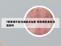 7银屑病不能泡温泉会加重 银屑病患者能泡温泉吗