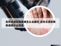 急性点滴型银屑病怎么治最好 急性点滴型银屑病用什么药愈