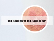 修美乐银屑病无效 修美乐银屑病 贴吧