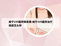 咸宁195医院银屑病 咸宁195医院治疗痘痘怎么样