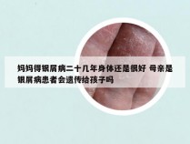 妈妈得银屑病二十几年身体还是很好 母亲是银屑病患者会遗传给孩子吗