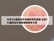 北京301医院治牛皮癣的专家是谁 北京301医院治疗银屑病需要多少钱
