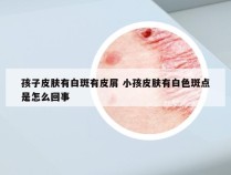 孩子皮肤有白斑有皮屑 小孩皮肤有白色斑点是怎么回事