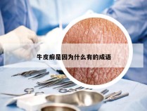牛皮癣是因为什么有的成语