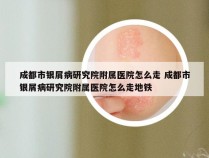 成都市银屑病研究院附属医院怎么走 成都市银屑病研究院附属医院怎么走地铁
