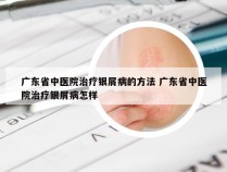 广东省中医院治疗银屑病的方法 广东省中医院治疗银屑病怎样