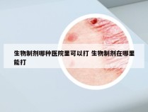 生物制剂哪种医院里可以打 生物制剂在哪里能打