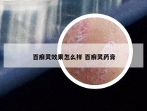 百癣灵效果怎么样 百癣灵药膏