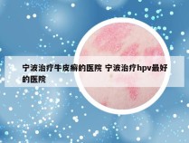 宁波治疗牛皮癣的医院 宁波治疗hpv最好的医院
