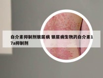 白介素抑制剂银屑病 银屑病生物药白介素17a抑制剂