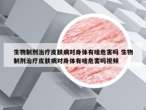 生物制剂治疗皮肤病对身体有啥危害吗 生物制剂治疗皮肤病对身体有啥危害吗视频