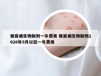 银屑病生物制剂一年费用 银屑病生物制剂2020年9月以后一年费用