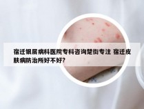 宿迁银屑病科医院专科咨询楚街专注 宿迁皮肤病防治所好不好?