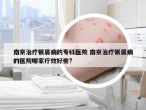 南京治疗银屑病的专科医院 南京治疗银屑病的医院哪家疗效好些?