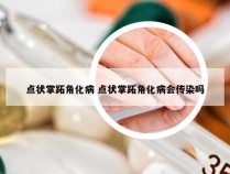 点状掌跖角化病 点状掌跖角化病会传染吗