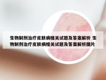 生物制剂治疗皮肤病相关试题及答案解析 生物制剂治疗皮肤病相关试题及答案解析图片