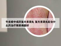 牛皮癣中成药复方青黛丸 复方青黛丸配合什么药治疗银屑病最好