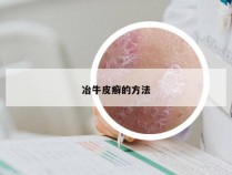 冶牛皮癣的方法