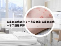 头皮银屑病15年了一直没复发 头皮银屑病一年了还是不好