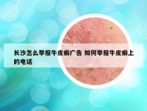 长沙怎么举报牛皮癣广告 如何举报牛皮癣上的电话