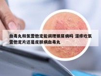 血毒丸和氯雷他定能调理银屑病吗 湿疹吃氯雷他定片还是皮肤病血毒丸