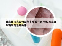 特应性皮炎生物制剂多少钱一针 特应性皮炎生物制剂治疗效果