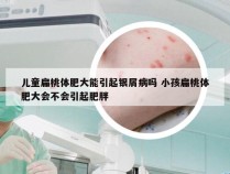 儿童扁桃体肥大能引起银屑病吗 小孩扁桃体肥大会不会引起肥胖