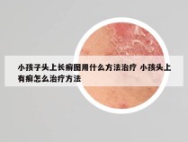 小孩子头上长癣图用什么方法治疗 小孩头上有癣怎么治疗方法
