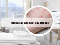 银屑病新药苯烯莫德 苯烯莫德乳膏