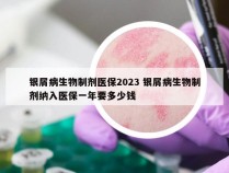 银屑病生物制剂医保2023 银屑病生物制剂纳入医保一年要多少钱