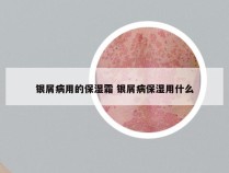 银屑病用的保湿霜 银屑病保湿用什么