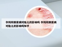 孕妈妈银屑病对胎儿的影响吗 孕妈妈银屑病对胎儿的影响吗知乎