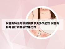 阿普斯特治疗银屑病关节炎多久起效 阿普斯特片治疗银屑病效果怎样